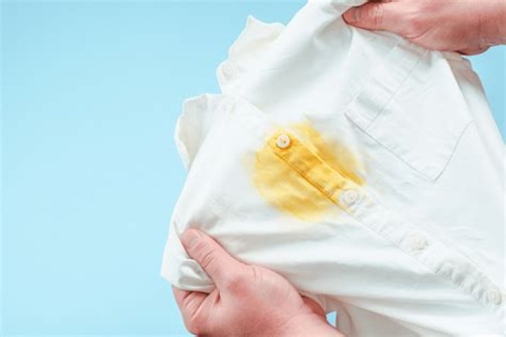 How do you get old yellow stains out of clothes?