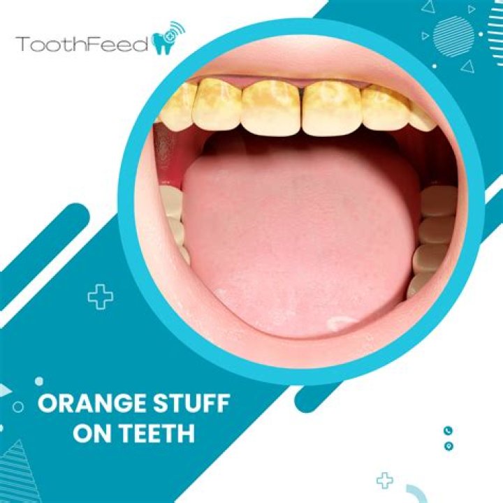 How do you get orange plaque off your teeth?