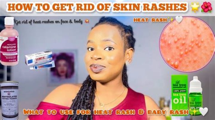 How do you get rid of shiny skin?