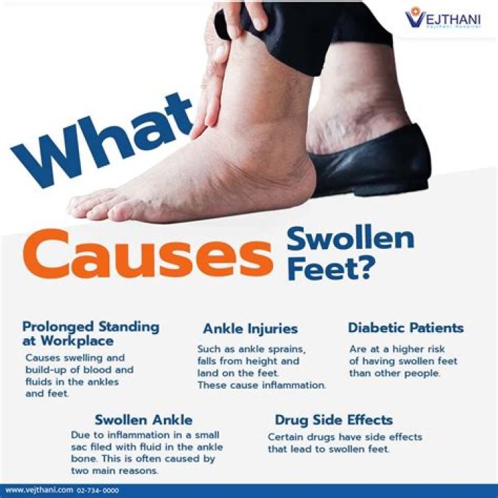 How do you get rid of swollen ankles fast?