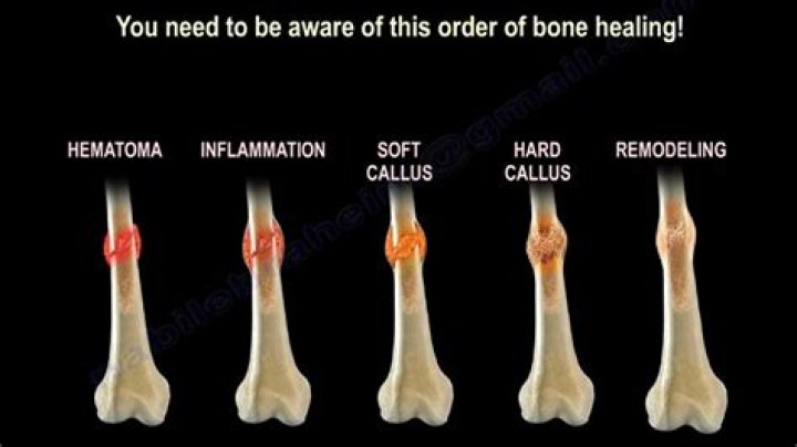 How do you know if a bone is dying?