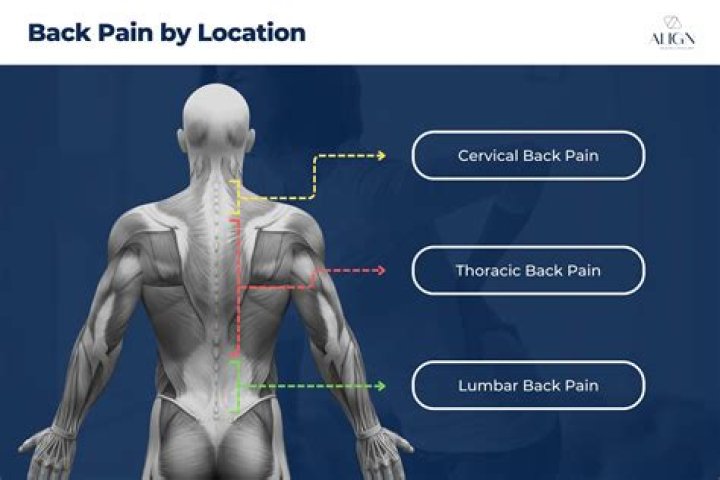 How do you know if back pain is muscular or spinal?