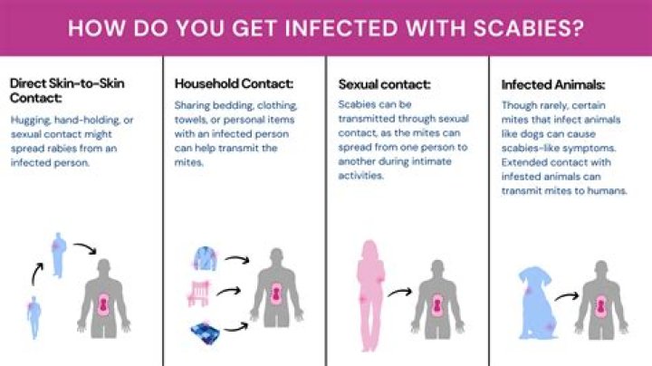 How do you prevent scabies from coming back?