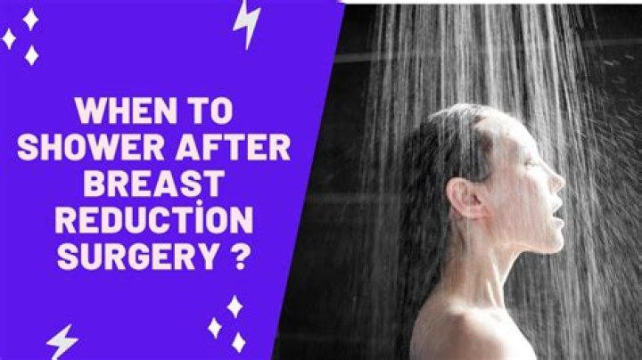 How do you shower after top surgery?