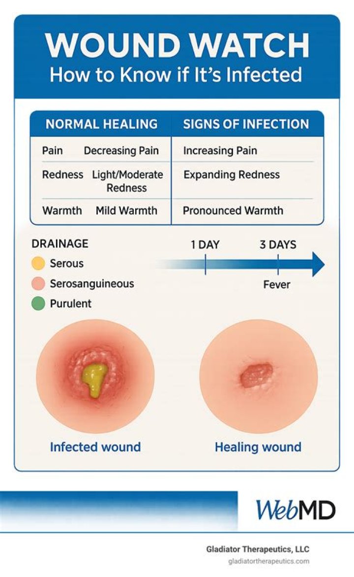 How do you tell if a cut is healing or infected?