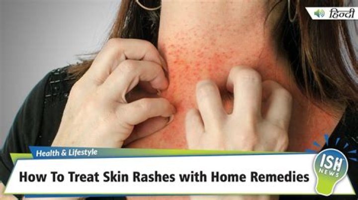 How do you treat ripped skin?