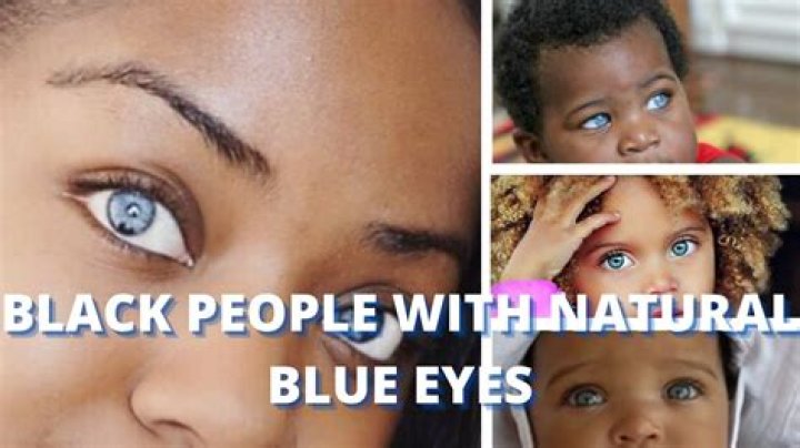 How does a black person get blue eyes?