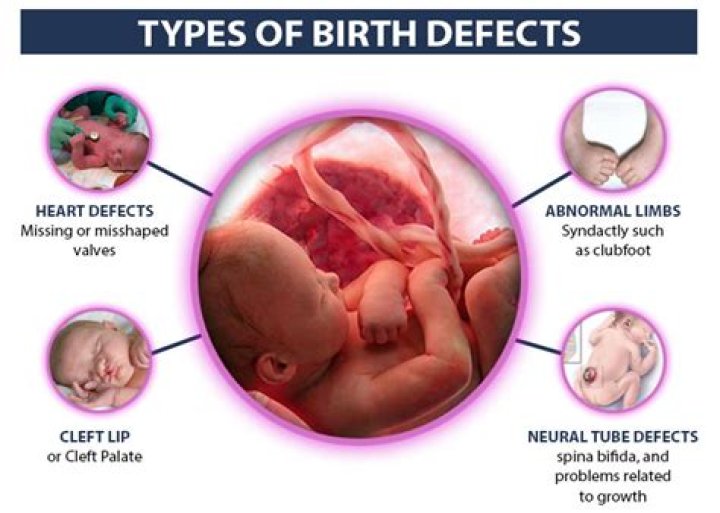 How early can birth defects be detected?