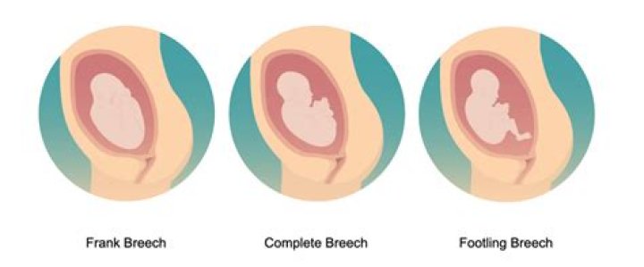 How long can babies stay in cradle?