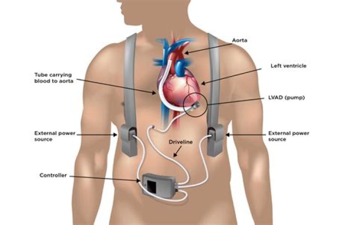 How long can someone be MIA?