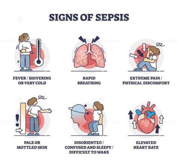 How long can you survive with sepsis?