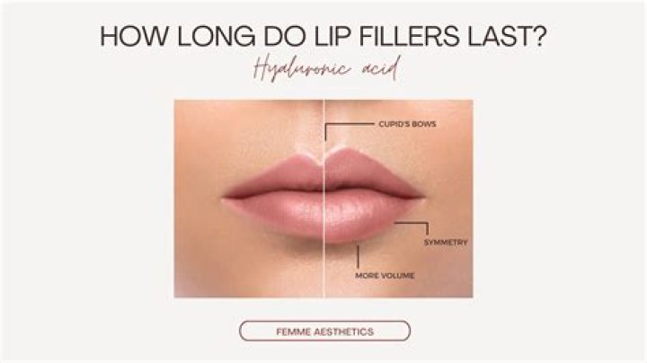 How long do lip hickeys last?