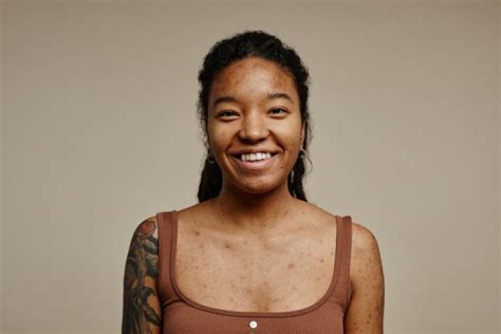 How long do tattoos stay raised?