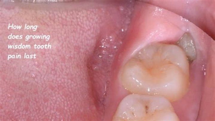 How long do teeth last for?