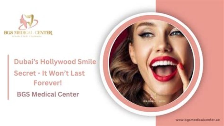 How long does a Hollywood smile last?
