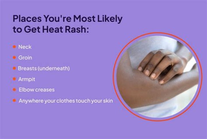 How long does a rash take to go away?