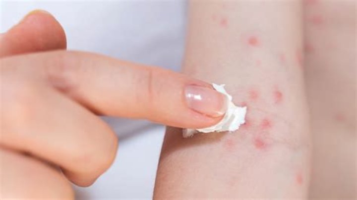 How long does it take for a rash from an allergic reaction to go away?