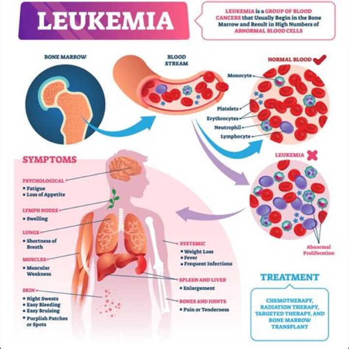 How long does it take for leukemia to go into remission?
