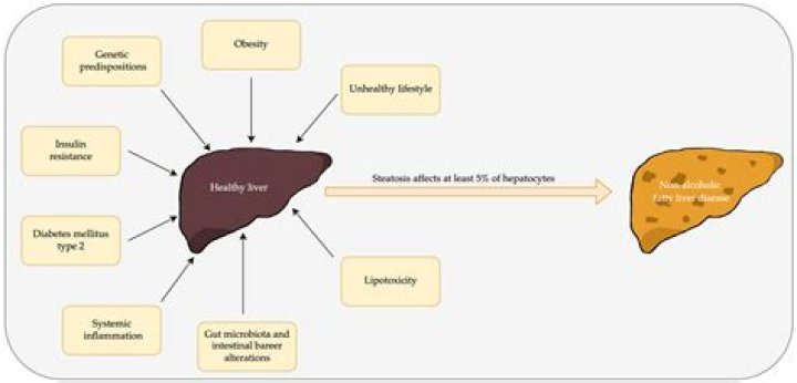 How long does it take to get rid of fatty liver?