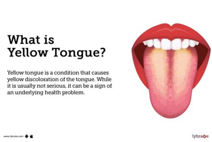 How long will yellow tongue last?