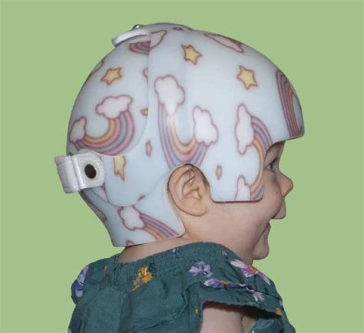 How many hours a day does a baby wear a cranial helmet?