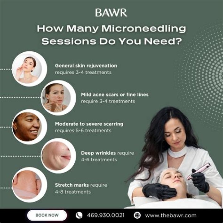 How many microneedling sessions does it take to see a difference?