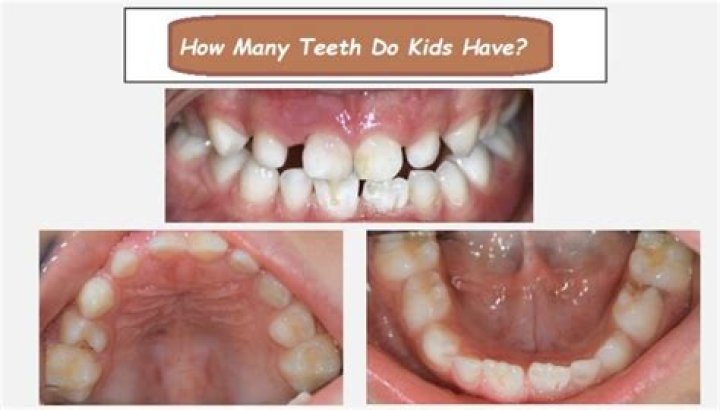 How many teeth should a 1.5 year old have?