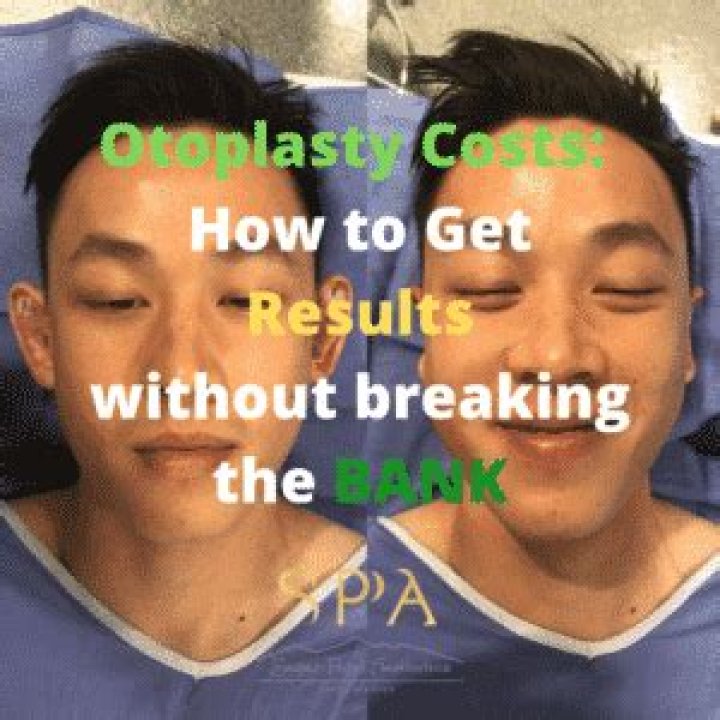 How much does an otoplasty cost?