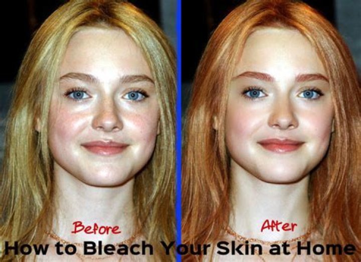 How much is it to bleach your skin?