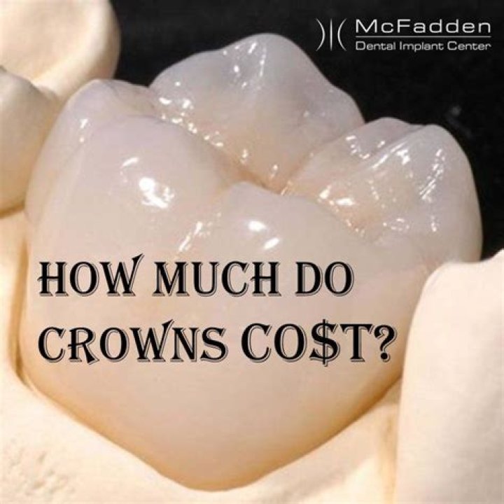 How much would a full set of crowns cost?