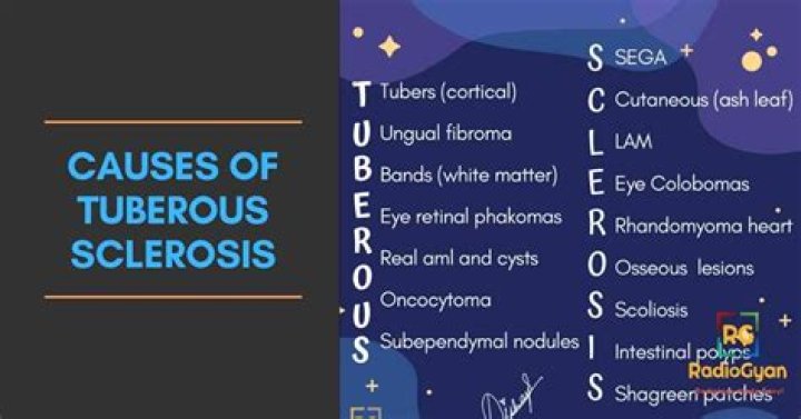 How rare is tuberous sclerosis?