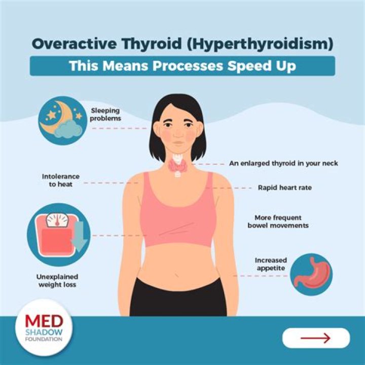 How urgent is a thyroid problem?