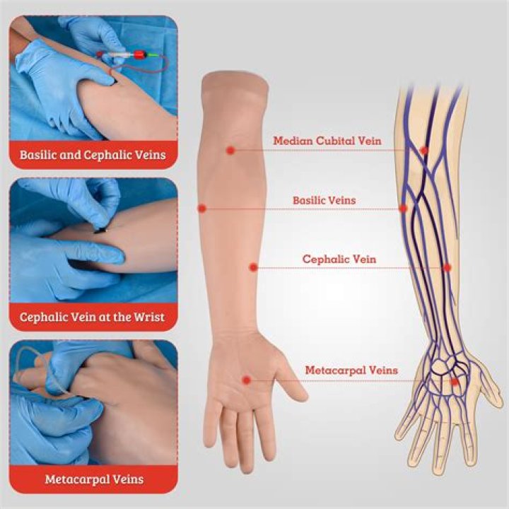 How will I feel after a venesection?