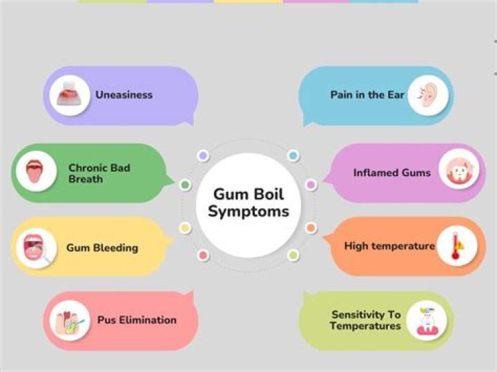 Is a gum boil an emergency?
