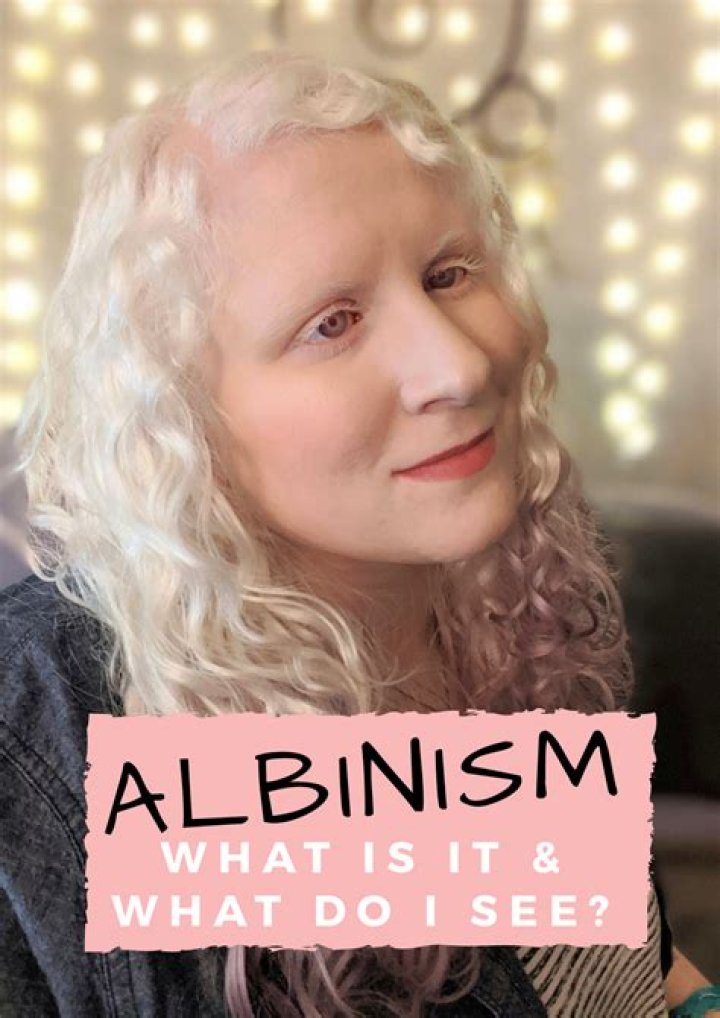 Is albinism a disability?