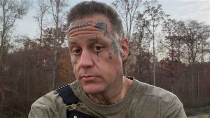 Is Barr getting his face tattoos removed?