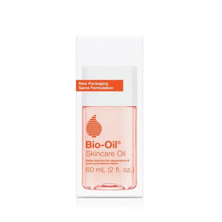 Is Bio oil good for freckles?