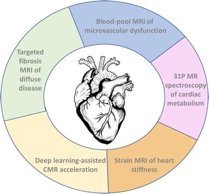 Is cardiac MRI better than echo?