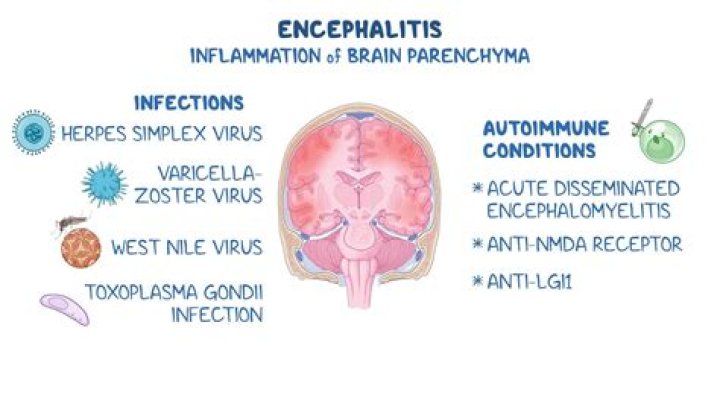 Is encephalopathy swelling of the brain?