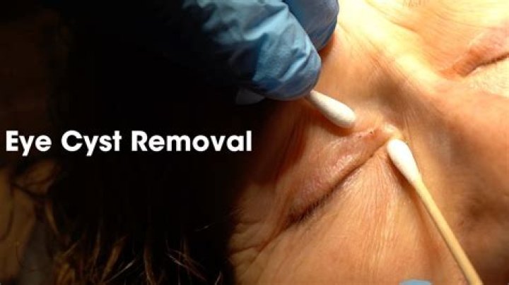 Is eye removal painful?