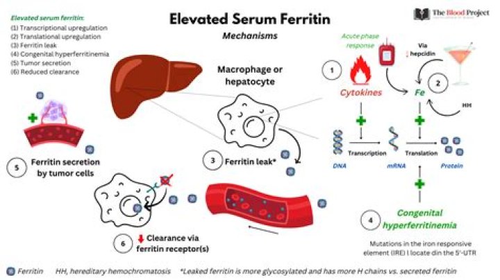 Is ferritin high in leukemia?