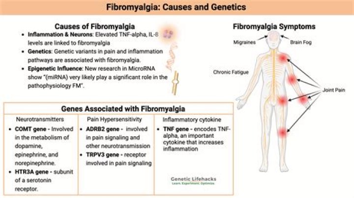 Is Fibromyalgia a connective tissue disease?