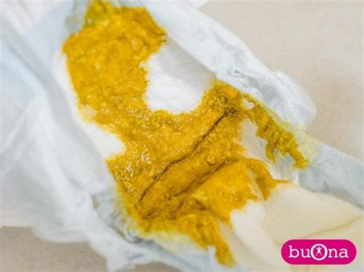 Is foamy baby poop normal?