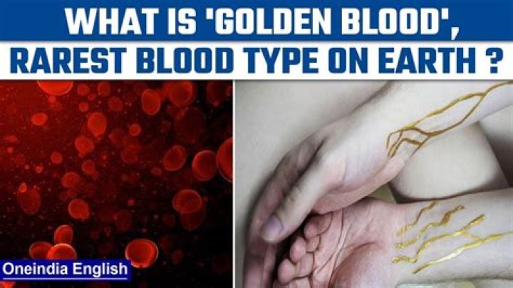 Is Golden blood golden in Colour?
