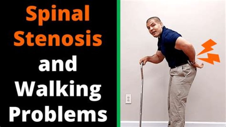 Is it good to walk with spinal stenosis?