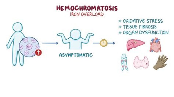 Is it hard to lose weight with hemochromatosis?