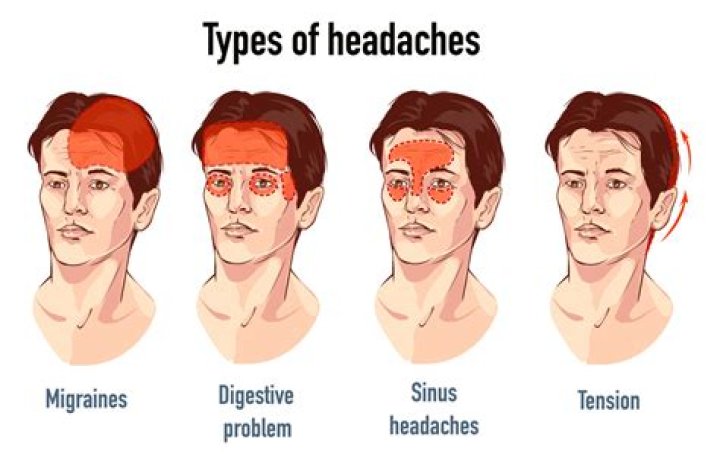 Is it normal to get a headache after microblading?