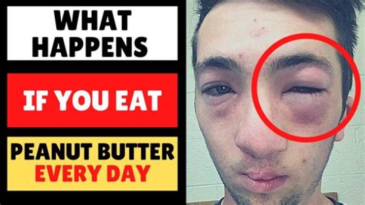 Is it OK to eat butter every day?