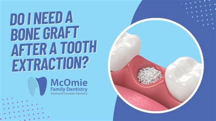 Is it OK to use Orajel after tooth extraction?