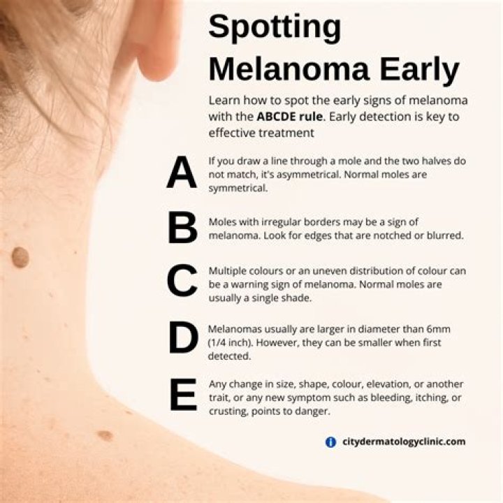 Is melanoma painful or itchy?